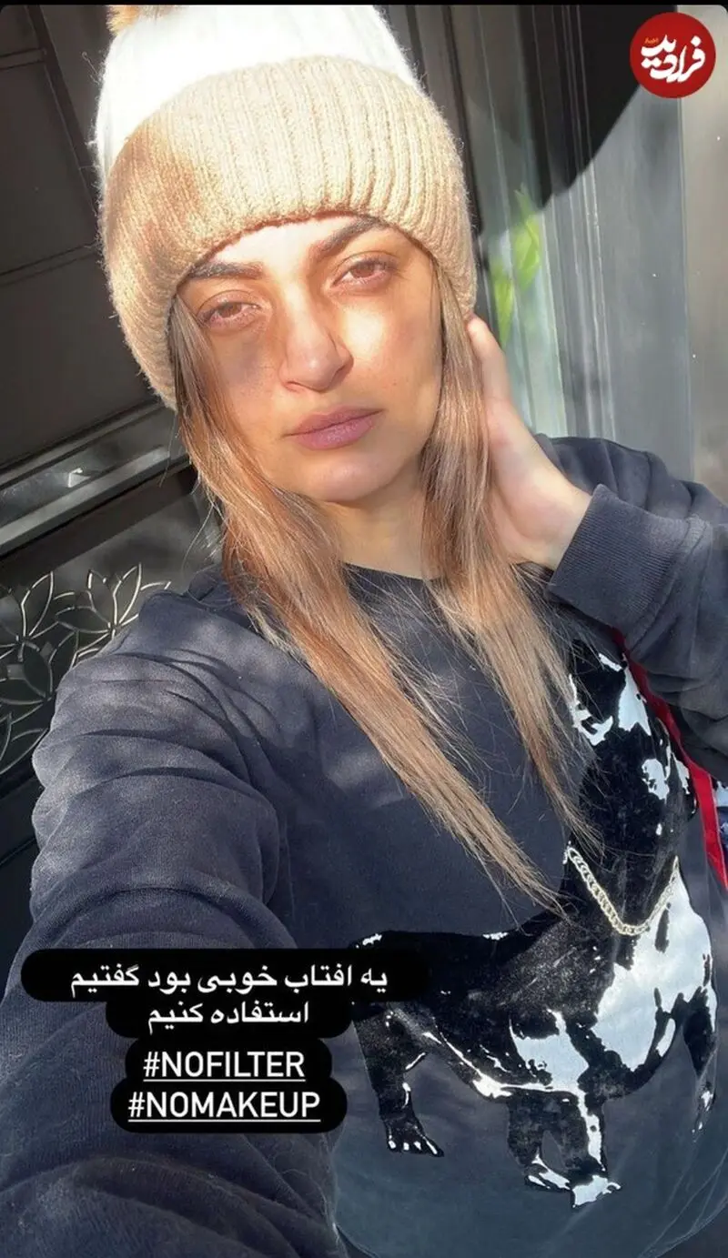 سفر در زمان / نیلوفر پارسا «بیتا» سریال آوای باران بعد 11سال در 35 سالگی