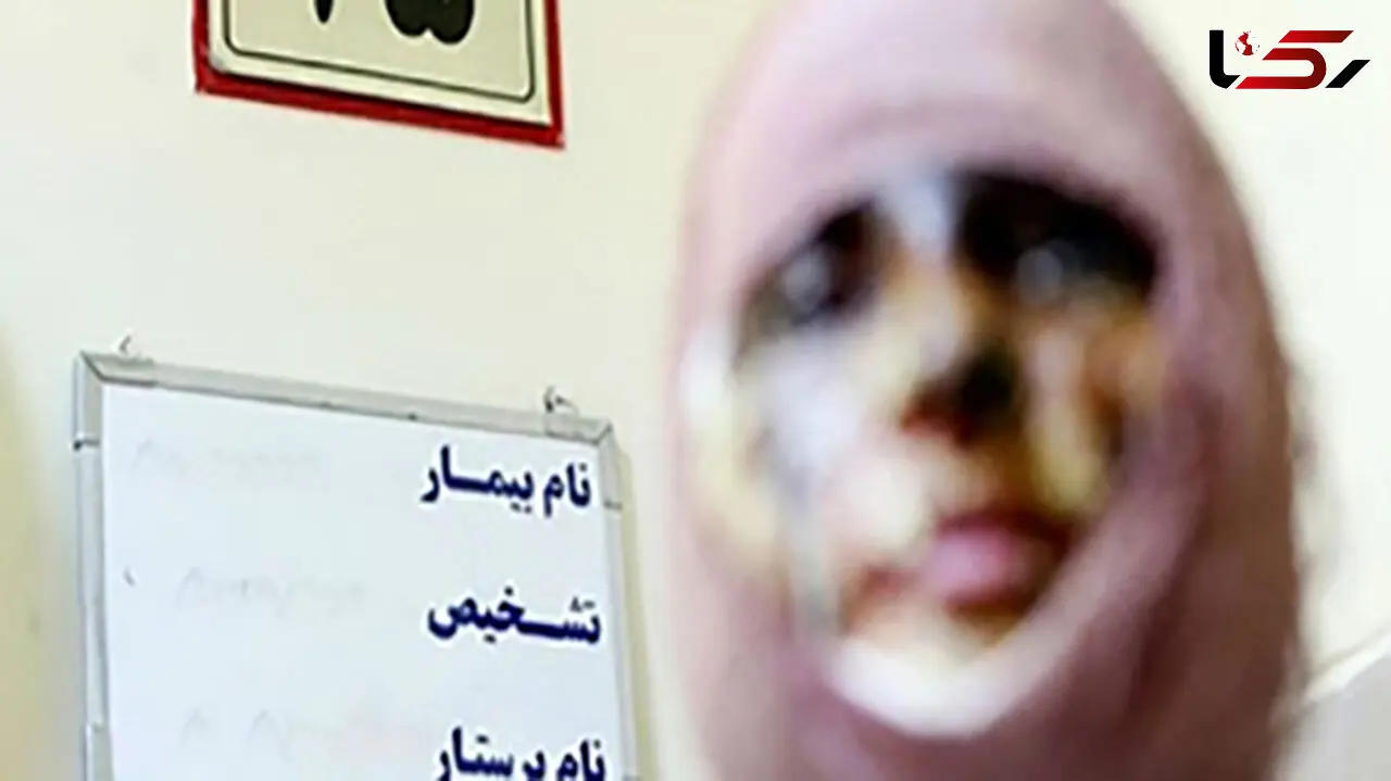 راز وحشتناک الهه در زندان زنان شهر ری! + عکس صورت دختر قبل و بعداز فاجعه

