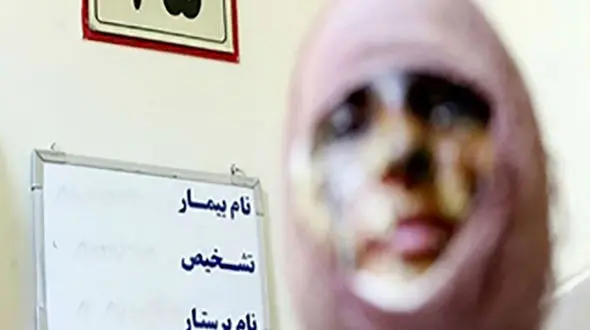 راز وحشتناک الهه در زندان زنان شهر ری! + عکس صورت دختر قبل و بعداز فاجعه
