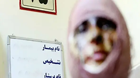 راز وحشتناک الهه در زندان زنان شهر ری! + عکس صورت دختر قبل و بعداز فاجعه
