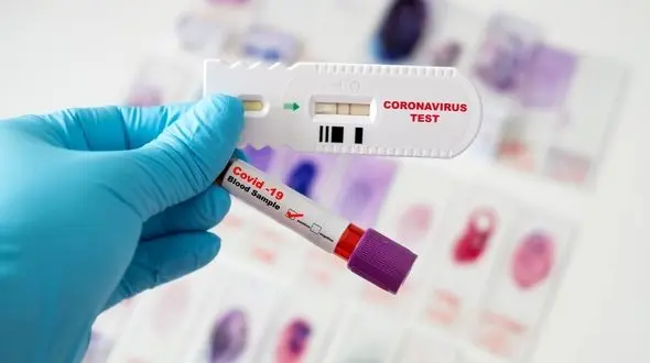 آمار کرونا در ایران تا امروز پنجم آبان ماه / ۱۹۷ ایرانی دیگر با ابتلا به کرونا جانباختند