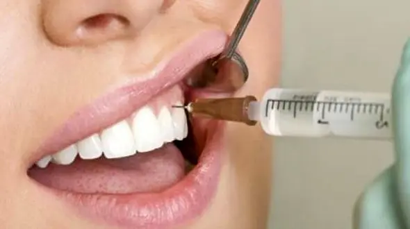 همه چیز درباره آمپول بی حسی دندان