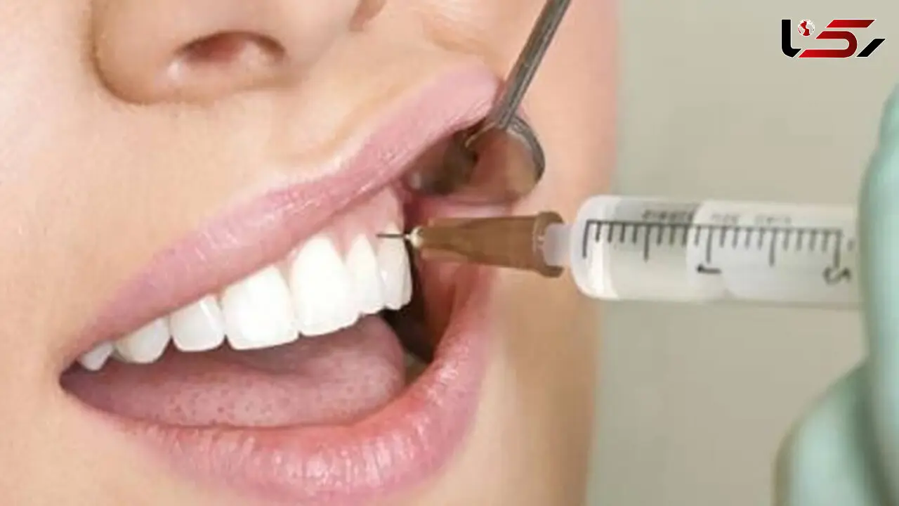 همه چیز درباره آمپول بی حسی دندان