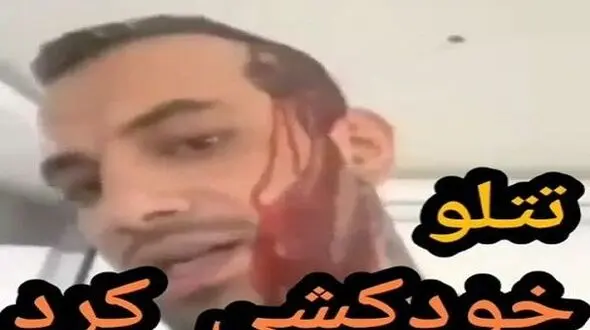 امیر تتلو بخاطر دختر معروف خودکشی کرد + عکس