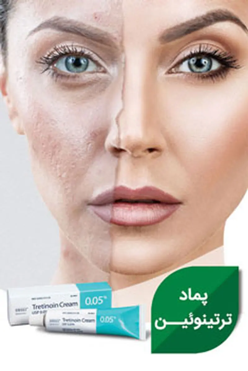 استفاده از پماد ترتینوئین