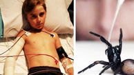 حمله مرگبارترین عنکبوت جهان به پسر بچه 10 ساله + عکس