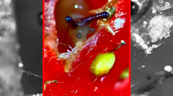 فیلم خطرات پنهان خوردن میوه نشسته