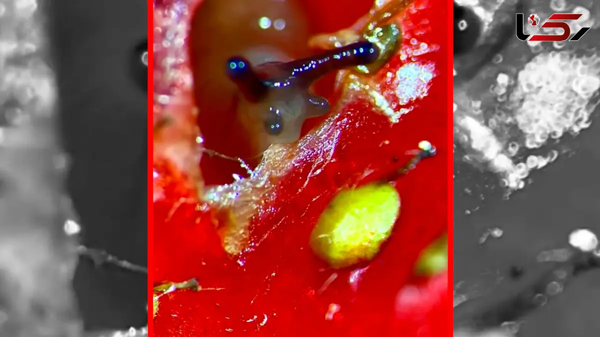 فیلم خطرات پنهان خوردن میوه نشسته