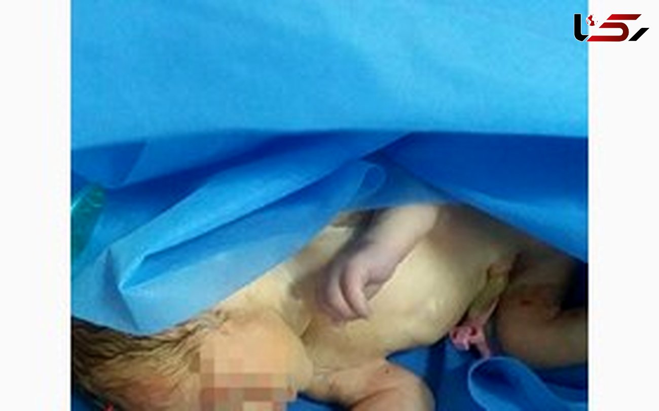این نوزاد تازه متولد شده در شهر مهاباد رها شده بود+عکس