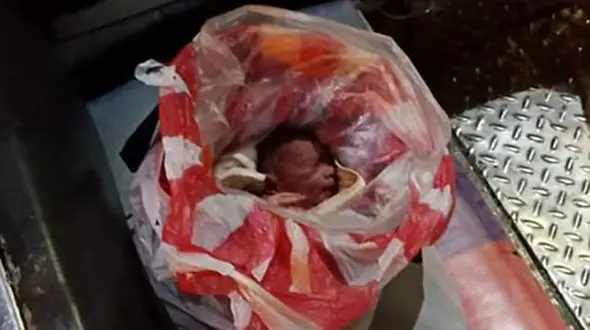 این نوزاد گریان را داخل کیسه پلاستیکی در خیابان رها کردند + تصاویر