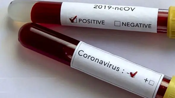 فعالیت 2 گیت تشخیص کرونا از مسافران در محور هراز