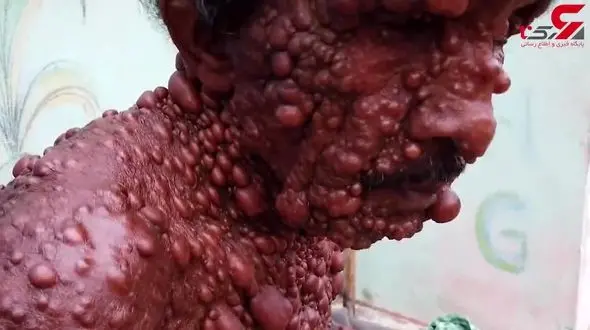 زندگی سخت و دردناک مرد سنگی در هند+فیلم