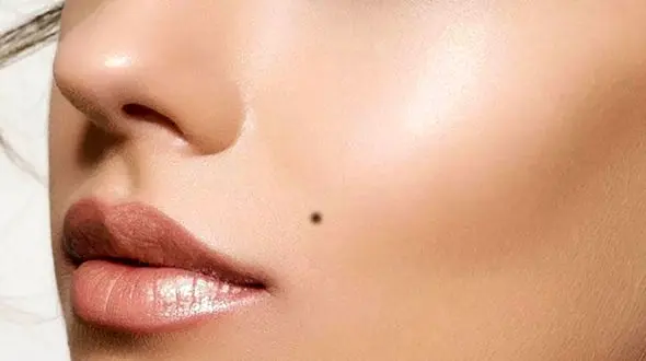 اگر خال روی بدنتان دارید این مطلب را بخوانید / خال چه راز هایی از شما فاش می کند؟!