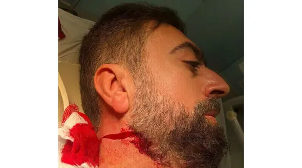 اولین عکس از روحانی تهرانی که با چاقو زخمی شد / در خیابان رودکی رخ داد