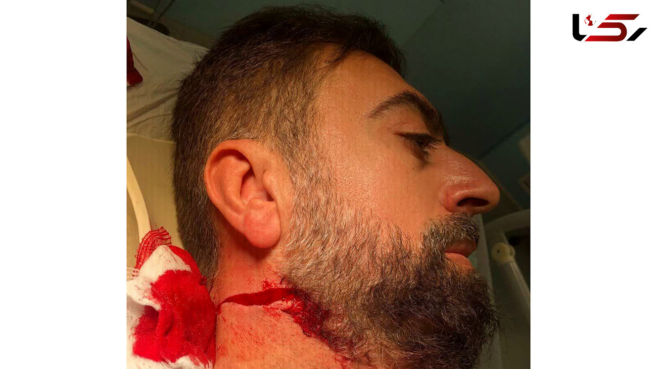 اولین عکس از روحانی تهرانی که با چاقو زخمی شد / در خیابان رودکی رخ داد