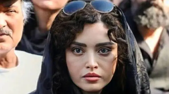 عکس از جزییات عمل های زیبایی بهنوش طباطبایی !