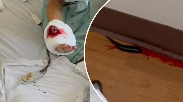  رد خون در بیمارستان راز دختر جوان را لو داد ! + فیلم