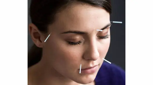 راه های درمان اضطراب با طب سوزنی 