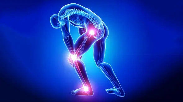 چرا در جوانی به آرتروز مبتلا می شویم؟