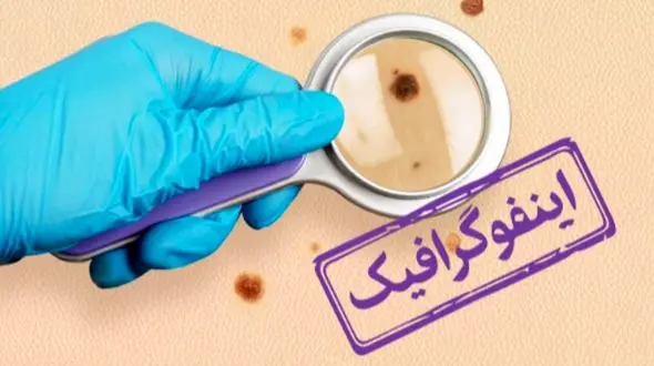 اینفوگرافیک: چگونه سرطان‌ های شایع در کشور را به موقع تشخیص دهیم؟