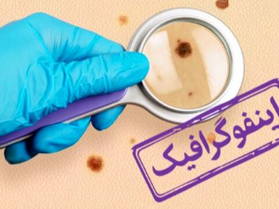 اینفوگرافیک: چگونه سرطان‌ های شایع در کشور را به موقع تشخیص دهیم؟