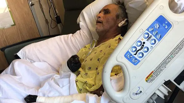  4 دست و پای این مرد جویده شدند! + عکس های دلخراش