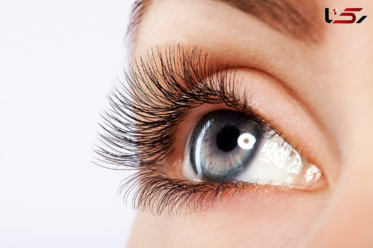 درمان کبودی چشم در سه سوت