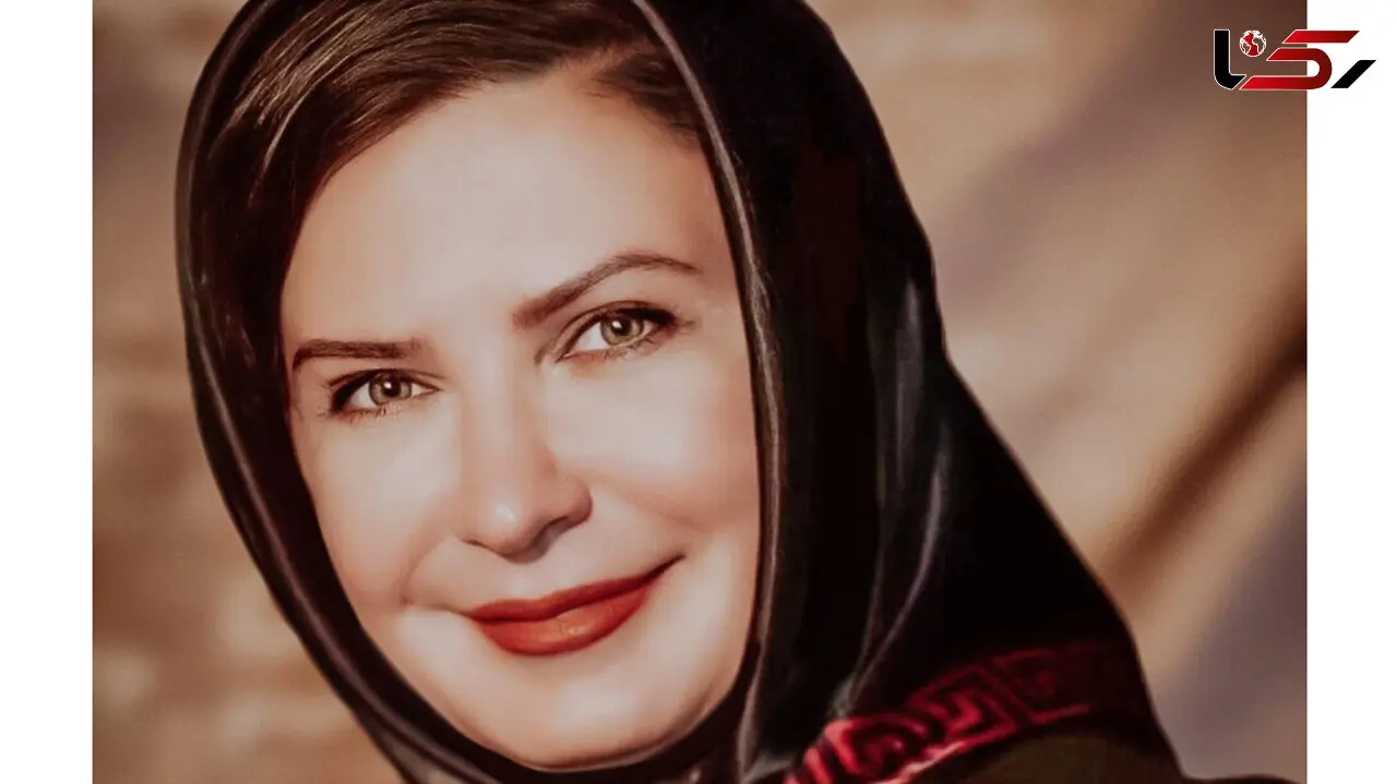 لعیا زنگنه اینجور صورت پیرش را جوان کرد / با این بوتاکس خانم بازیگر ا نمی شناسید !