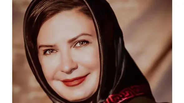 لعیا زنگنه اینجور صورت پیرش را جوان کرد / با این بوتاکس خانم بازیگر ا نمی شناسید !