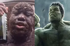 این مرد زشت ترین هیولای جهان شد / فیلم بیماری ای که باور نمی کنید  چهره این مرد را سنگی کرد