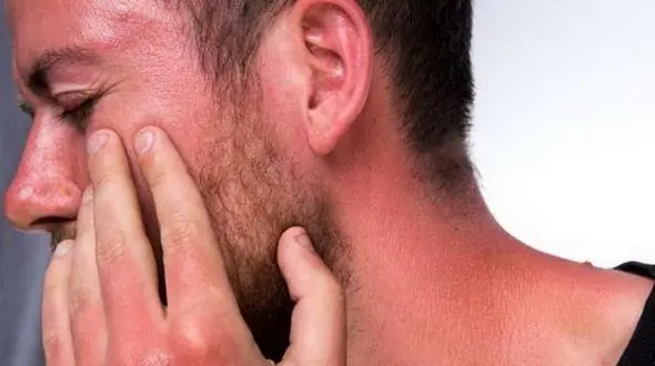 درمان سوختگی بدن با طب سنتی