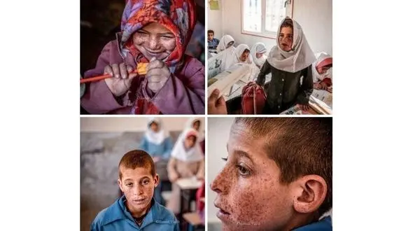 آقای وزیر بهداشت کودکان "لجنگ"به کمک پزشکی نیاز دارند/ تکرار گزارش از درگیری اهالی روستا با بیماری پوستی خطرناک