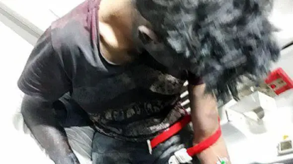  مواد محترقه دست یک نوجوان اصفهانی را قطع کرد