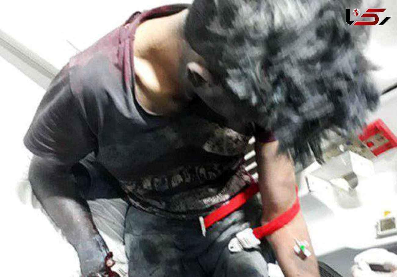  مواد محترقه دست یک نوجوان اصفهانی را قطع کرد