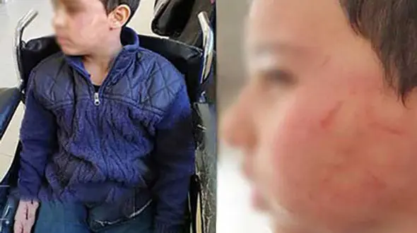 انتشار عکس های دردناک از شکنجه دانش آموز در شیراز 