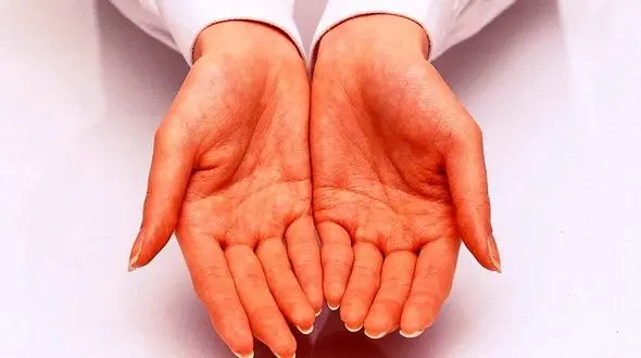 مرگبارترین باکتری که با انسان زندگی می کند