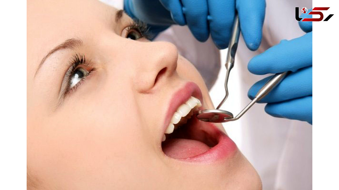 هشدار یک متخصص دندانپزشک در خصوص "لبخندهای هالیودی"