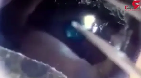 خارج کردن ۱۱ کرم زنده از چشم یک نوزاد! +فیلم