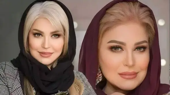 عکس جگرسوز از پیری  اکرم محمدی ! / ناگهان 100 سال پیر شد !