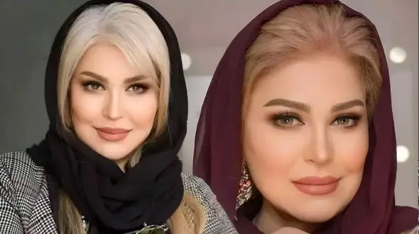 عکس جگرسوز از پیری  اکرم محمدی ! / ناگهان 100 سال پیر شد !