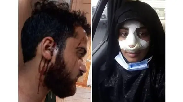 کتک زدن طلبه جوان و همسرش در مهرشهر کرج + عکس