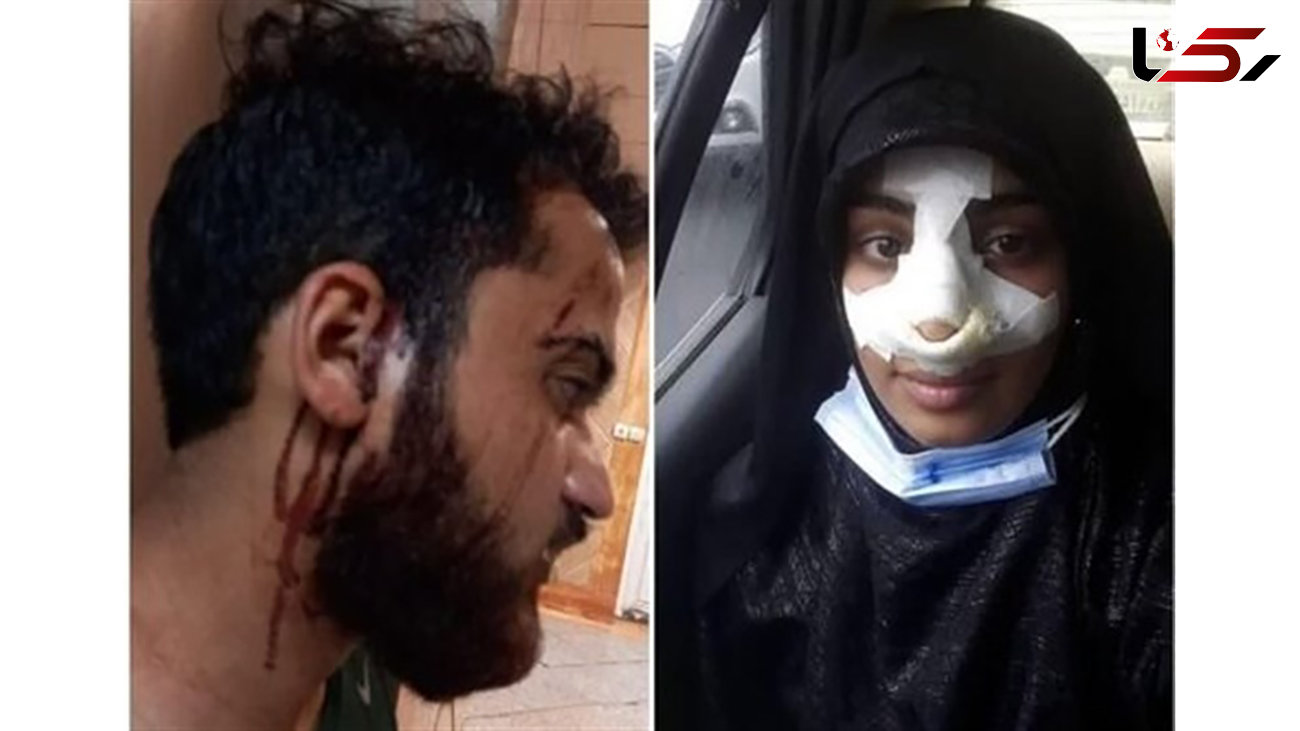 کتک زدن طلبه جوان و همسرش در مهرشهر کرج + عکس