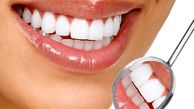 سفید کردن دندان با زغال؛ روشی بدون هزینه