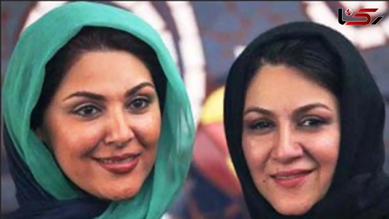 شیک پوشی خواهران اسکندری / شکسته شدن چهره ستاره اسکندری شوکه کننده است !