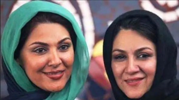 شیک پوشی خواهران اسکندری / شکسته شدن چهره ستاره اسکندری شوکه کننده است !