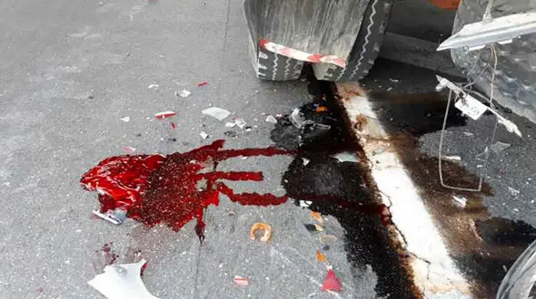 تصادف شدید بین کامیونت و موتورسیکلت