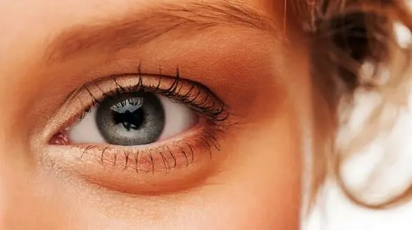 معجزه 48 ساعته برای خلاص شدن از تیرگی دور چشم 
