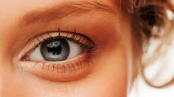 معجزه 48 ساعته برای خلاص شدن از تیرگی دور چشم 