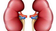 بیماران کلیوی دور این مواد غذایی را خط بکشند