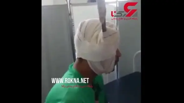 رفتارهای خونسردانه مردی با چاقویی فرو رفته در سرش + فیلم عجیب